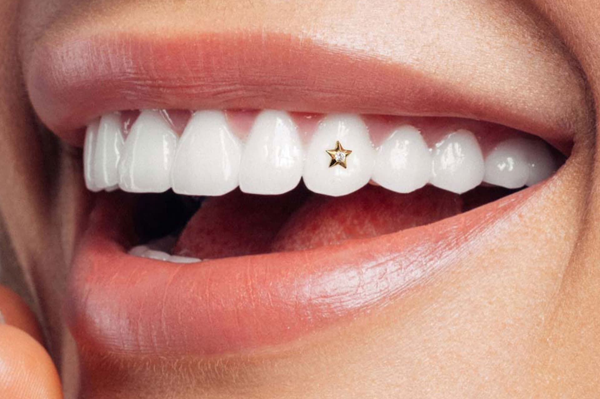Tooth Jewelry
